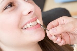 Veneers – Keramische Verblendschalen mit großer Wirkung | Zahnarzt Berlin